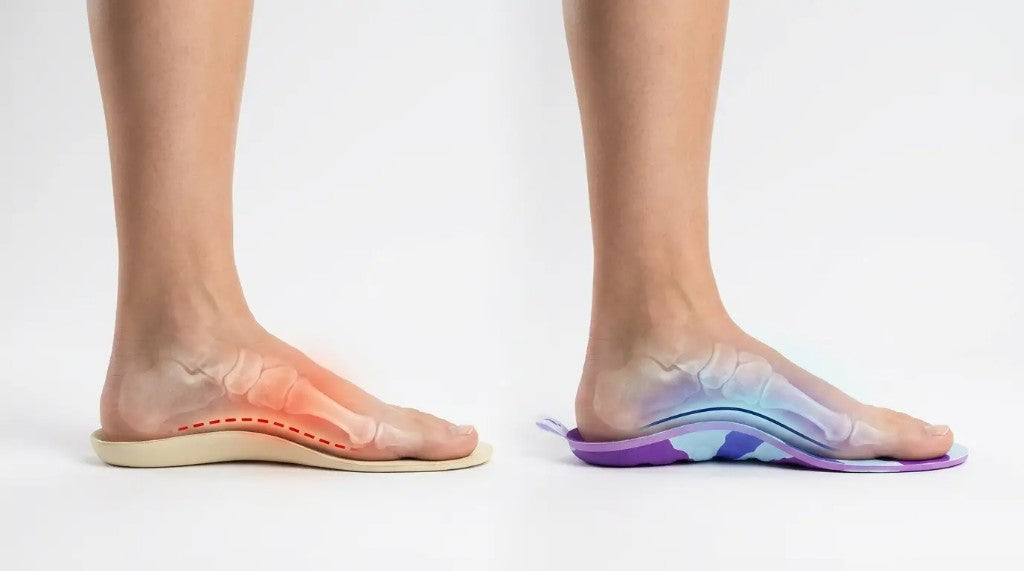 RegenRx semi-rigid arch compared with a soft gel insole